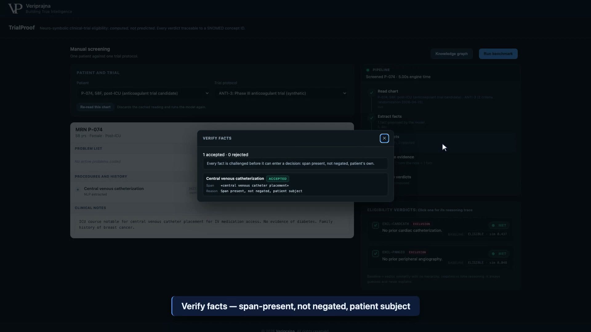 TrialProof Verify Facts panel showing every proposed fact challenged for span present, negation, and subject before it can enter a decision